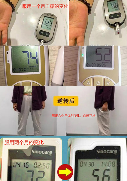 山楂葛根丸用戶(hù)反饋